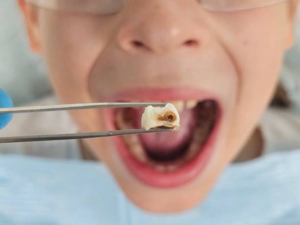 Best Emergency Dental Services for Seniors in Maple Glen, PA